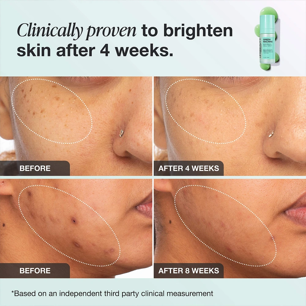 Green Machine Vitamin C Dark Spot & Hyperpigmentation Serum