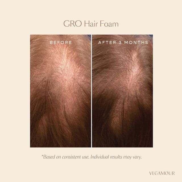 GRO Hair Foam for Thinning Hair