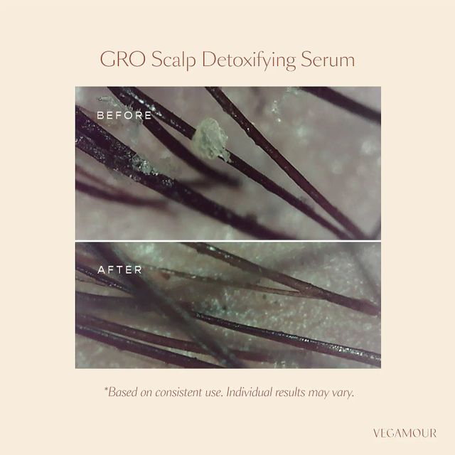 GRO Scalp Detox Clarifying Treatment for Dry, Flaky, Oily Scalp