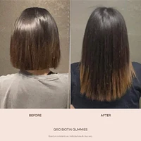 GRO Biotin Gummies for Thinning Hair
