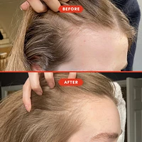 HoliRoots™ Pre-Wash Treatment Oil for Thinning Hair