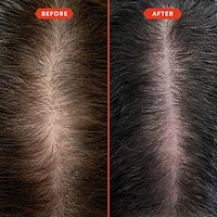 HoliRoots™ Pre-Wash Treatment Oil for Thinning Hair