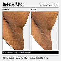 The Deodorant Gel - With 5% Alpha Hydroxy Acid (AHA) and Niacinamide