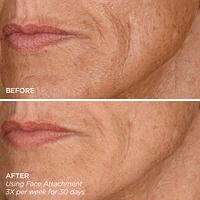 Get That Glow - GloPRO® Microneedling Tool & Discovery Set
