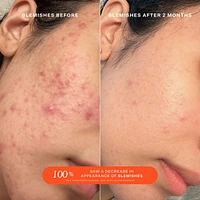 SOS Daily Rescue Facial Spray with Hypochlorous Acid