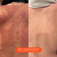 SOS Daily Rescue Facial Spray with Hypochlorous Acid