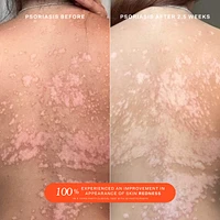 SOS Daily Rescue Facial Spray with Hypochlorous Acid