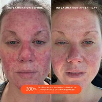 SOS Daily Rescue Facial Spray with Hypochlorous Acid