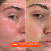 SOS Daily Rescue Facial Spray with Hypochlorous Acid