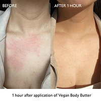 Moisturizing Vegan Body Butter