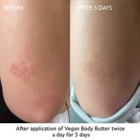 Moisturizing Vegan Body Butter