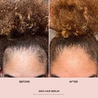 GRO Hair Serum Trio for Thinning Hair