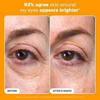 C5 Super Boost Vitamin C Eye Cream for Brightening & Firming