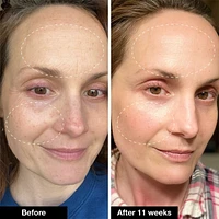 Retinol Remix 1% Retinol Treatment With Peptide & Tranexamic Acid