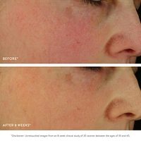 GOOPGLOW Exfoliating Dark Spot Sleep Serum