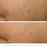 GOOPGLOW Exfoliating Dark Spot Sleep Serum