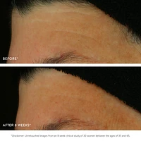 GOOPGLOW Exfoliating Dark Spot Sleep Serum