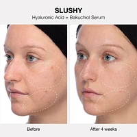 The Healthy Skin Edit Bestsellers Kit