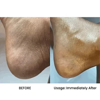 AFRICAN Beauty Butter- Intensive Dry Skin Treatment