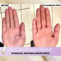 AFRICAN Beauty Butter- Intensive Dry Skin Treatment