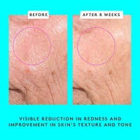 Bouncy Brightfacial Brightening Mask with 10% Azelaic Acid + 1% Salicylic Acid