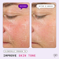 Major Fade Hyper Serum Dark Spot Treatment