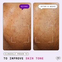 Major Fade Active Seal Dark Spot Vitamin C Gel Moisturizer