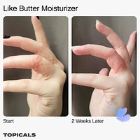 Like Butter Moisturizer for Dry, Sensitive & Eczema-Prone Skin