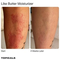 Like Butter Moisturizer for Dry, Sensitive & Eczema-Prone Skin