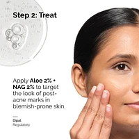 Aloe 2% + NAG 2% Solution for Post-Acne Marks