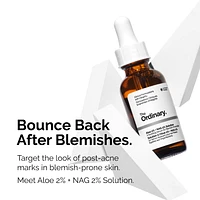 Aloe 2% + NAG 2% Solution for Post-Acne Marks