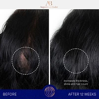 The Hair Treatment System