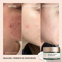 Probiotic Balancing Gel Moisturizer + Squalane
