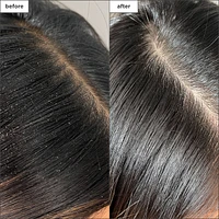 Scalp Revival™ Charcoal + Tea Tree Buildup Detox Spray