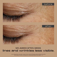 WRINKLE + TEXTURE CONCENTRATE with 0.2% Encapsulated Retinol, Vitamin C & Azelaic Acid