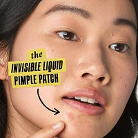 Truly Targeted Acne-Clearing Salicylic Acid Pimple Patch 