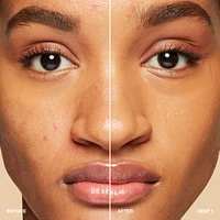 Vitamin Enriched Hydrating Skin Tint SPF 15 with Hyaluronic Acid