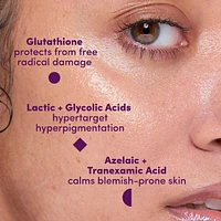 UNSPOTTED 4X Dark Spot + Hyperpigmentation AHA Serum