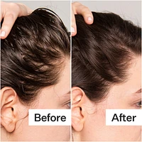 Salicylic Acid Scalp Renew Exfoliator For Oily + Flakey Scalp