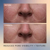 Honey Glow 17% AHA + BHA Resurfacing Acid Serum