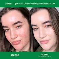 Cicapair™ Redness Rescue Kit for Sensitive Skin