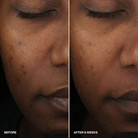 Vitamin Enriched Smoothing Serum with Niacinamide 
