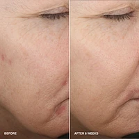 Vitamin Enriched Smoothing Serum with Niacinamide 
