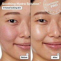 Soothing Hydra Solution™ PRO Face Mask for Irritated Skin