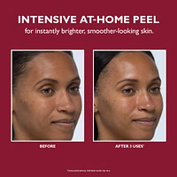 Even Smoother™ Instant Reveal Facial Peel