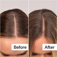 Daily Hydro™ Scalp Serum with Hyaluronic Acid for Dry Scalp