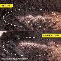 Densifying & Thickening Serum for Thinning Hair