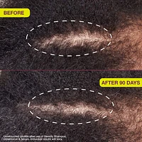 Densifying & Thickening Serum for Thinning Hair