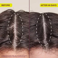 Densifying & Thickening Serum for Thinning Hair