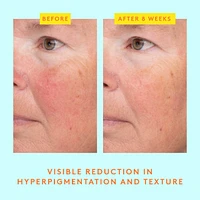 C-Luma Hydrabright Gentle Hydrating Vitamin C Serum
